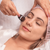 Dermaroller Treatment Kandivali