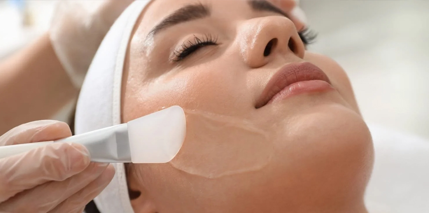 Chemical Peels Treatment Doctor in Kandivali East and West - Dr. Pinky Mehta